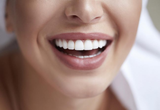 Metodi rapidi per Ottenere Denti Più Bianchi a Casa