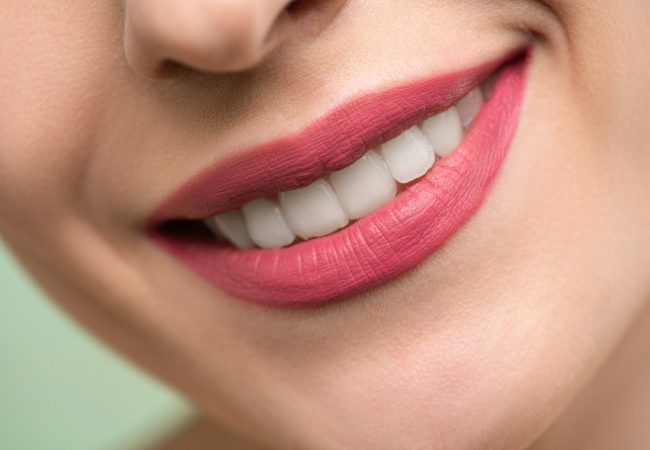 Come si Ottengono un Sorriso Smagliante e dei Denti Super-Bianchi?